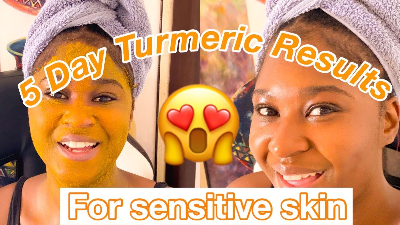 EASY DIY TURMERIC MASK On Sensitive Skin For 5 DaysRecipe, Benefits