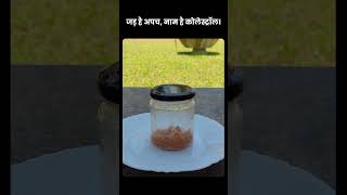 जड़ है अपच, नाम है कोलेस्ट्रॉल।
