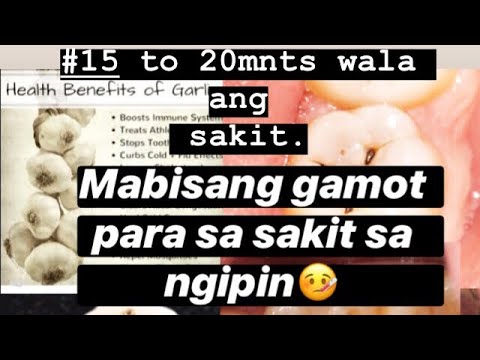 Mga Gamot Para Sa Sakit Ng Ngipin