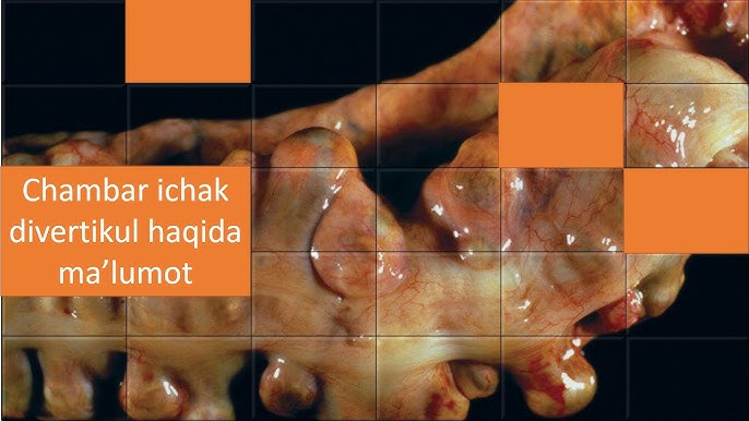 Porno suratda erkak bor