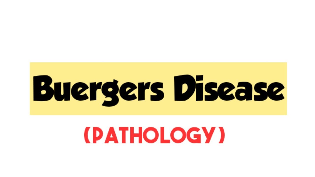 Buergers disease/medium vessel vasculitis/ pathology /mbbs YouTube