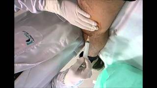 Sangre la de tengo detrás coágulo rodilla un creo de que