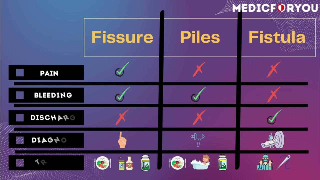 differences-between-piles-fistula-and-fissures-key-features-youtube
