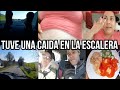 TUVE UNA CAÍDA EN LA ESCALERA+TERMINE EN EL HOSPITAL+NO ME PUEDO MOVER+USANDO PAMPERS