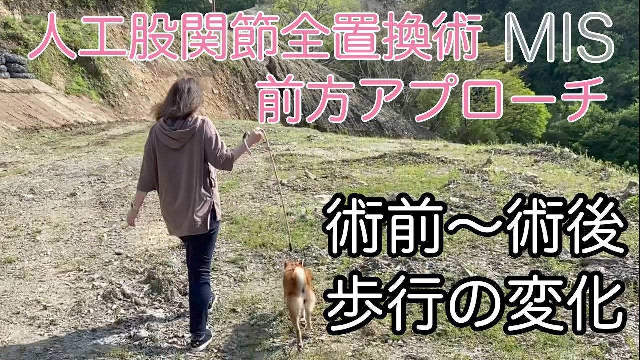 人工股関節置換術の術前から術後16日迄の歩行の変化。【入院の話①】