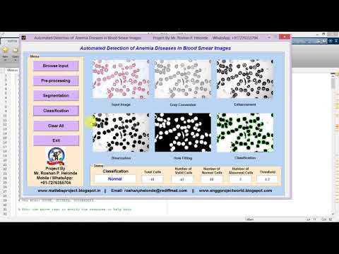 Anemia Detection in Blood Smear Images Using Image Processing Matlab Project Code