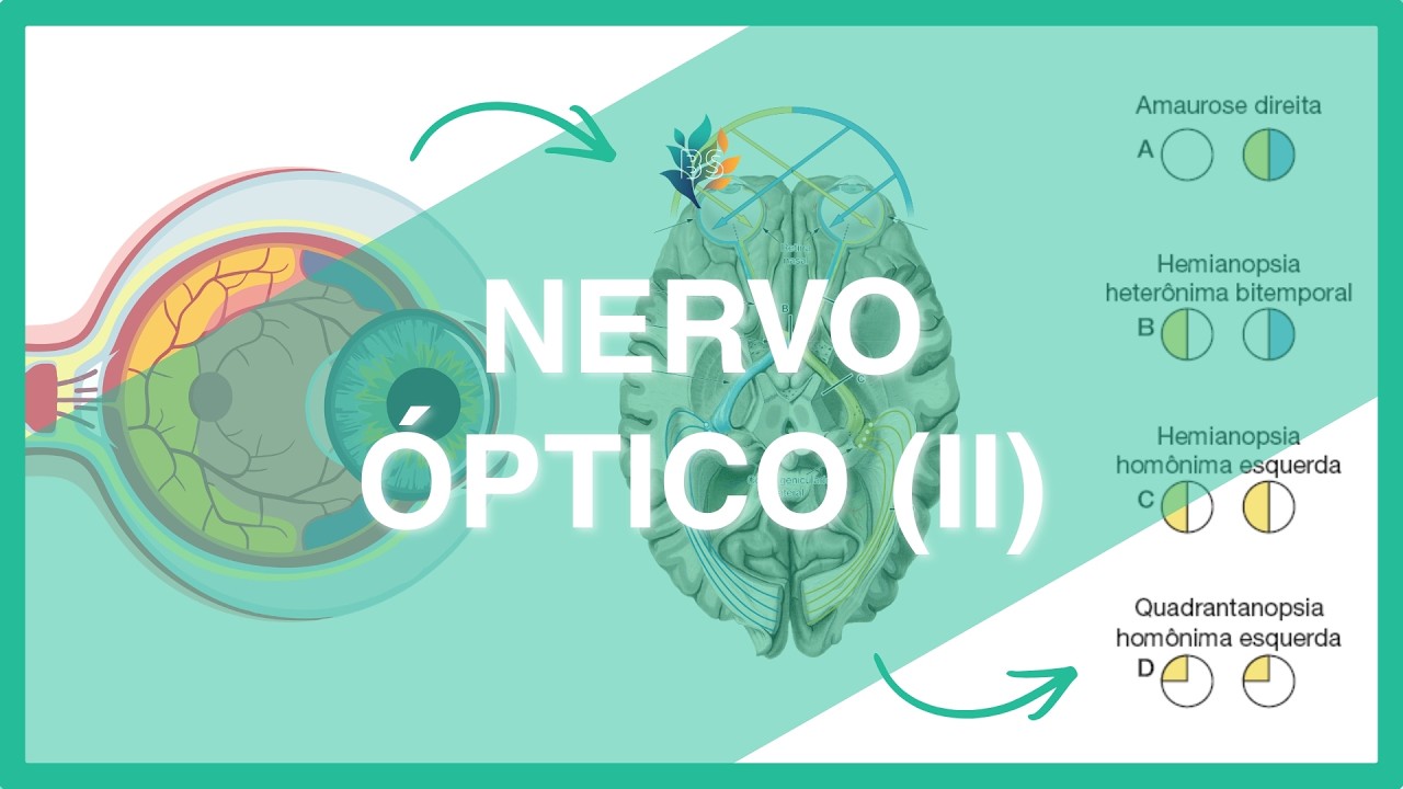 NERVO ÓPTICO (II): Via óptica e alterações do campo visual descomplicadas
