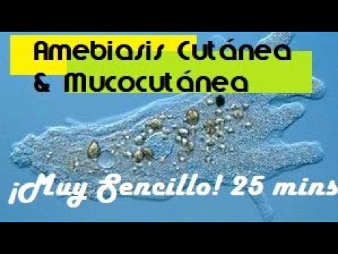 Βίντεο: Λοίμωξη Ameba σε γάτες - Feline Amebiasis - Αιτία διάρροιας γάτας