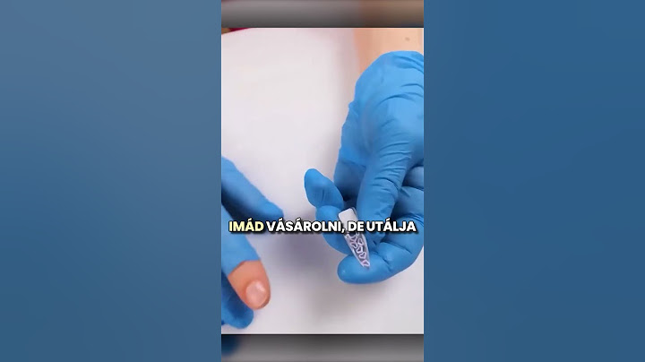 Chipet Ültetett A Körmébe! 😱
