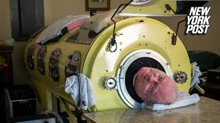 Polio Paul Alexander, who spent 72 years inside iron lung, dead at 78