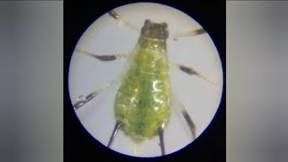 Aphid and their shedded skin under a microscope