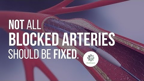 Not All Blocked Heart Arteries Should Be Fixed. Here’s Why. HealthspanMD