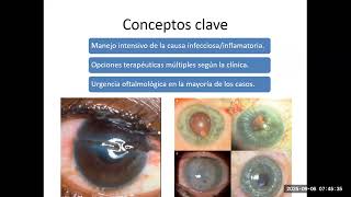 Tratamiento del Adelgazamiento, Lisis, y la Perforación Corneal