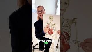 Stroke Recovery: From Wheelchair to Walking Again!
