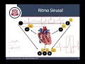 ¿Como interpretar cualquier Electrocardiograma?