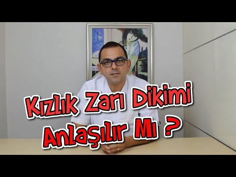 Video: Himenoplasti Ile Kızlık Zarının Yeniden Yapılandırılması