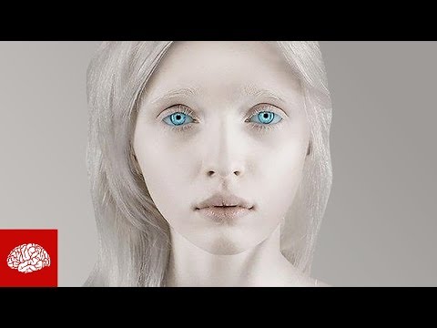 Video: Warum Werden Albino-Menschen Geboren?
