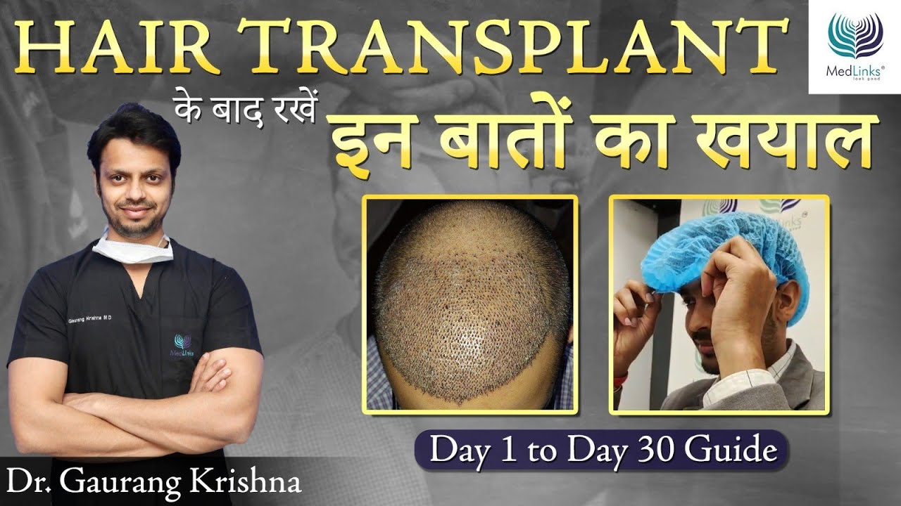 हेयर ट्रांसप्लांट के बाद क्या करे? After Hair Transplant Care in 2024 | Medlinks Hair Transplant