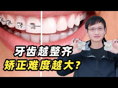 明明牙齿还挺整齐的！正畸医生却说你的矫正难度更大？