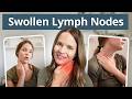 Lymphatic Drainage for Swollen Lymph Nodes