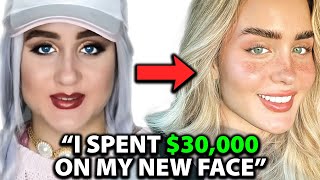 I was UGLY Before Spending $30,000 on a NEW FACE | Surgeon Reacts