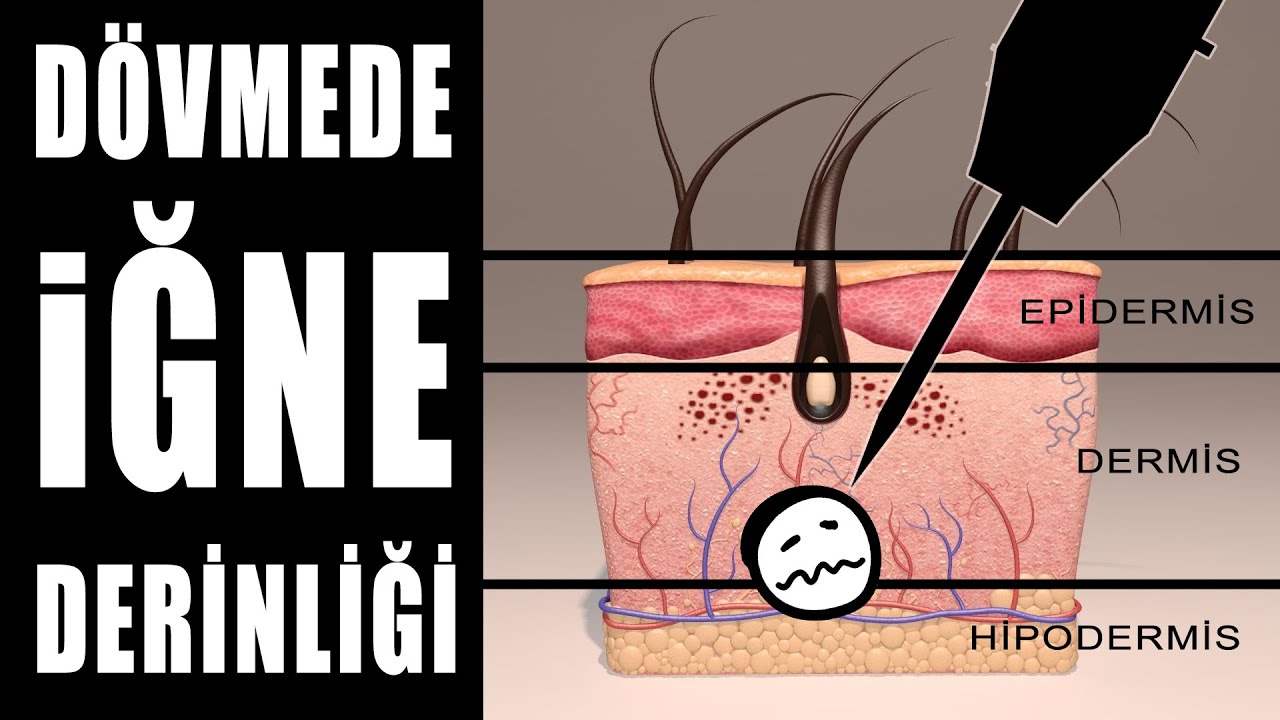 Dövmede İğne Derinliği ( DÖVME YAPARKEN İĞNEYİ DERİYE NE KADAR SOKMALIYIM ?)