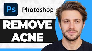 How to Remove Acne Defects from Faces in Photoshop (2026 Guide) screenshot 1