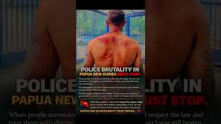 POLICE BRUTALITY IN PNG MUST STOP
