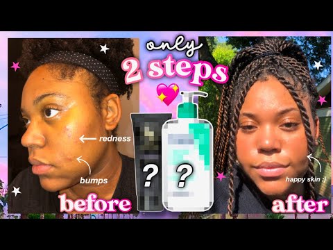 My two step skincare routine (2021)