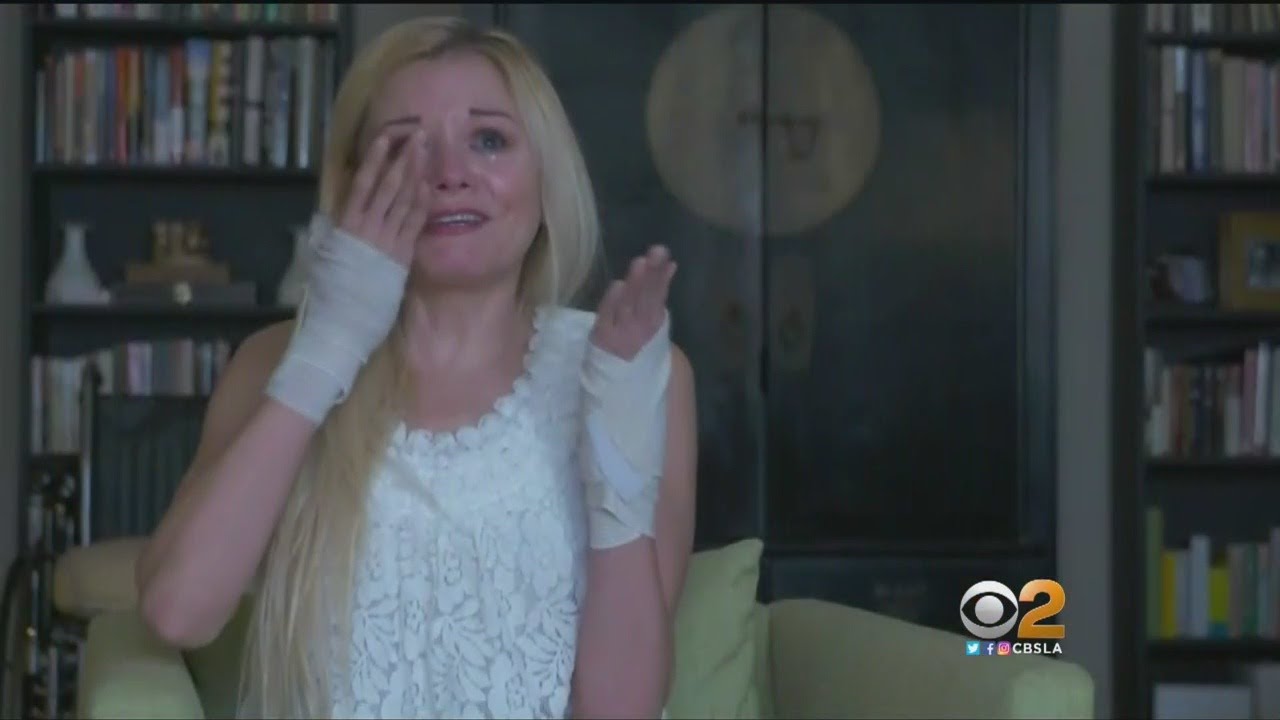 Nanny Permanently Injured After Saving Child From Oncoming Car Pleads For Help - 