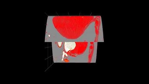 AtomicusChart®: Volume Rendering Customizations