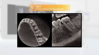 About RAYSCAN Alpha Plus | Advanced Dental CBCT Imaging Solution