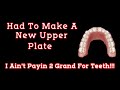 Making A New Upper Partial Denture (I Ain't Payin 2 Grand For Teeth!!)