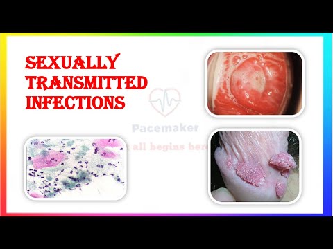 SEXUALLY TRANSMITTED DISEASES PART 1, STD&rsquo;s , CONDYLOMA ACCUMINATA, HERPES GENITALIS, CHANCROID