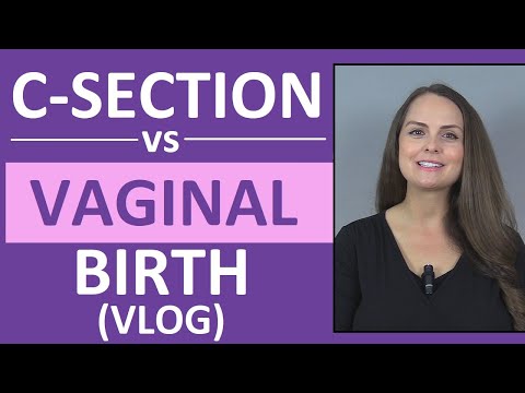 C-Section vs Vaginal Birth Delivery: My Experience | Birth Vlog