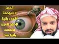 رقية قوية جدا لخروج العين والحسد والتخلص من الأذى رقية قوية جدا لخروج العين والحسد والتخلص من الأذى