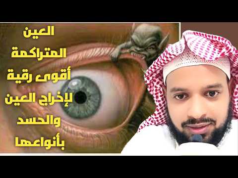 🛡️ الرقية الشرعية لعلاج السحر والحسد والمس