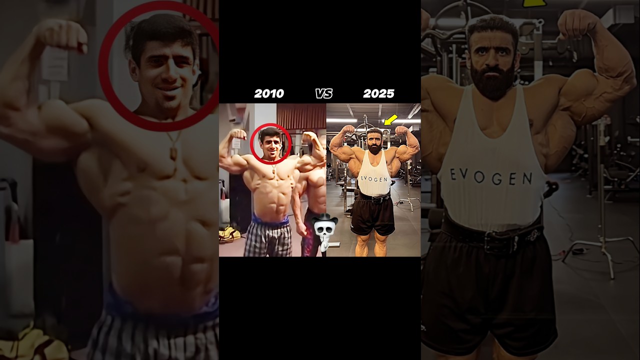 HADI CHOOPAN IN 2010 VS 2025 🥶MR OLYMPIYA 