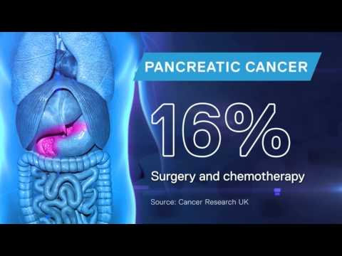 New pancreatic cancer drug treatment 'extends survival'