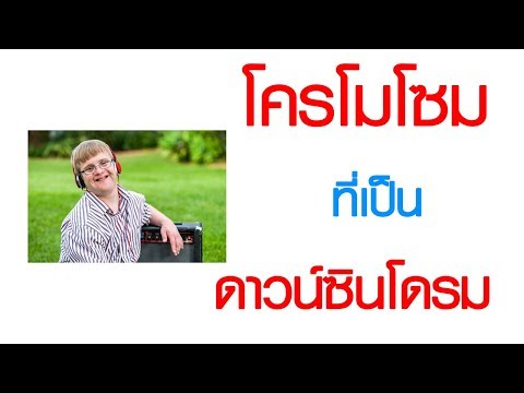 พบหมอเสรี ตอนที่ 332 : โครโมโซม ที่เป็นดาวน์ซินโดรม
