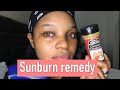 How to get rid of sunburn fast on the face /Natural home remedy for sunburns