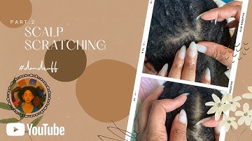 Scalp Scratch#asmrsound #asmrcommunity #asmrvideo #scratch #dandruff #asmrforrelaxing #asmrforsleep