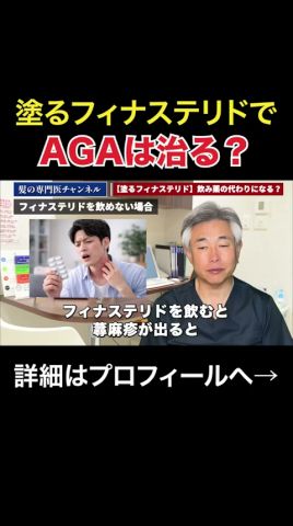 【塗るフィナステリド】飮むフィナステリドの代わりになるのか#shorts #aga #植毛