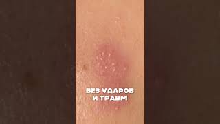 Состояние здоровья и кожи #shorts