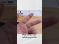 Sehat dengan Cara Sujok : Mengobati Rasa Takut #Shorts