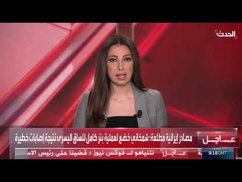 مستشار المرشد الإيراني يخضع لعملية بتر في الساق اليسرى