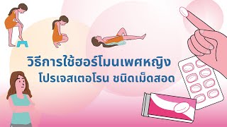วิธีการใช้ฮอร์โมนเพศหญิง โปรเจสเตอโรนชนิดเม็ดสอดช่องคลอด screenshot 2
