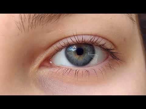 Blink Of An