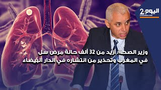 وزير الصحة: أزيد من 32 ألف حالة مرض سل في المغرب وتحذير من انتشاره في الدار البيضاء