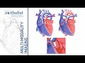 Congenital Heart Disease I: A Primer for the Imager (C. Huie Lin, MD) March 17, 2020